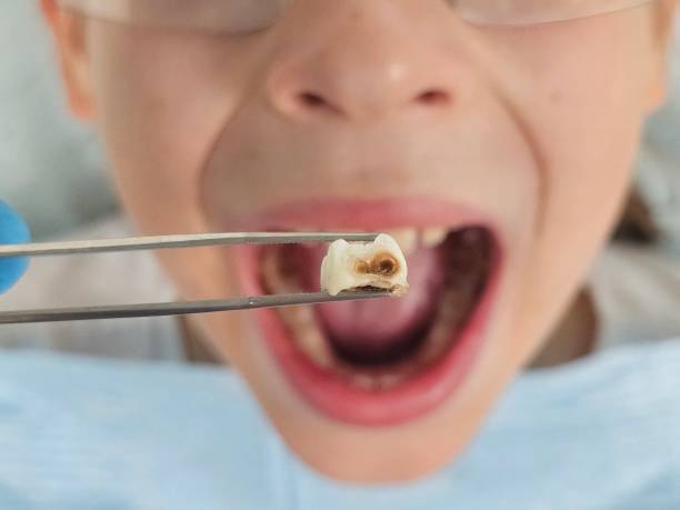 Best Weekend Emergency Dentist in Sterling, KS